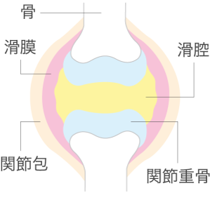 関節リウマチの関節破壊ステージⅠ（初期）