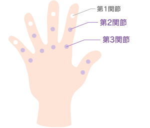 症状が出やすい手指の第2・3関節